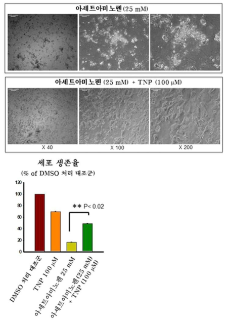 TNP에 의한 APAP-induced hepatotoxicity 억제반응 (인간 줄기세포 유래 간세포)