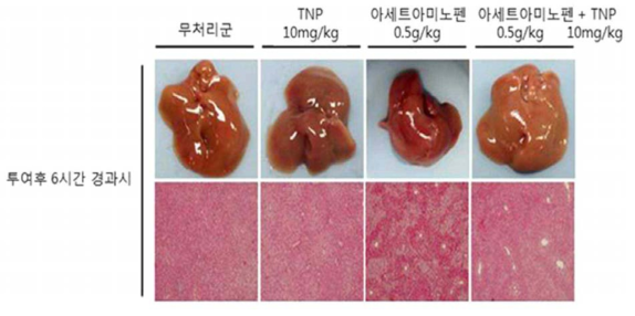 생쥐모델에서의 TNP 처리에 따른 APAP 간독성 보호효능분석 (개체생존율)