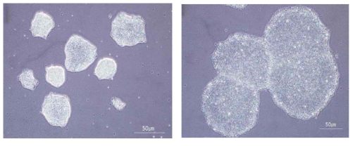 초기 간세포 분화단계에서 conditioned medium 배양기간에 따른 분화 효율 확인실험 왼쪽: hESC배양 2일, 오른쪽: hESC배양 3일