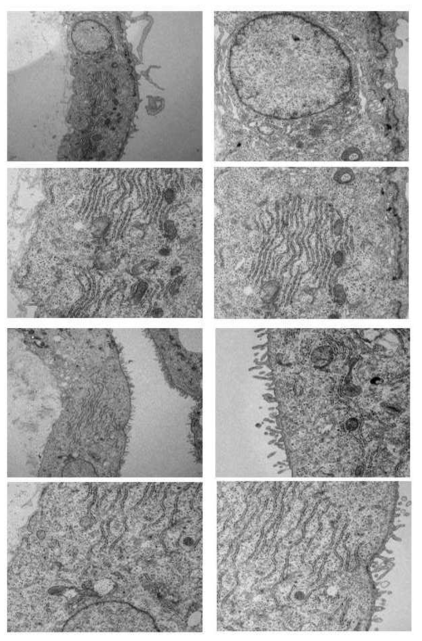 분화 간세포의 transmission electron microscopy 분석