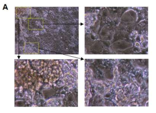 줄기세포 유래 분화 간세포의 모양관찰