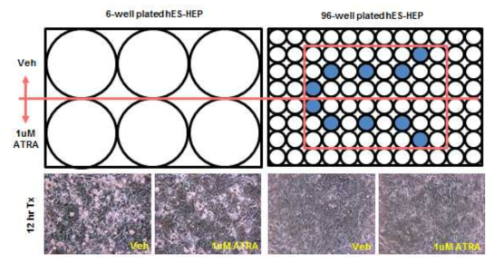 HTS 간세포에서의 ATRA 처리실험 및 세포모양관찰