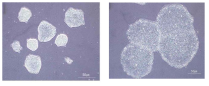 초기 간세포 분화단계에서 conditioned medium 배양기간에 따른 분화 효율 확인실험 왼쪽: hESC배양 2일, 오른쪽: hESC배양 3일