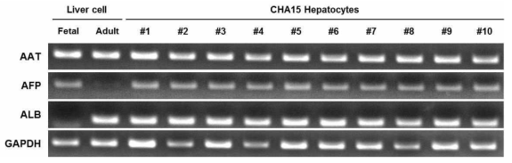 분화 간세포 검증 및 능력 검증 유전자 발현 분석 (RT-PCR)