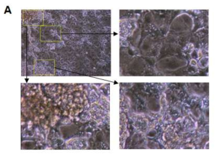 줄기세포 유래 분화 간세포의 모양관찰