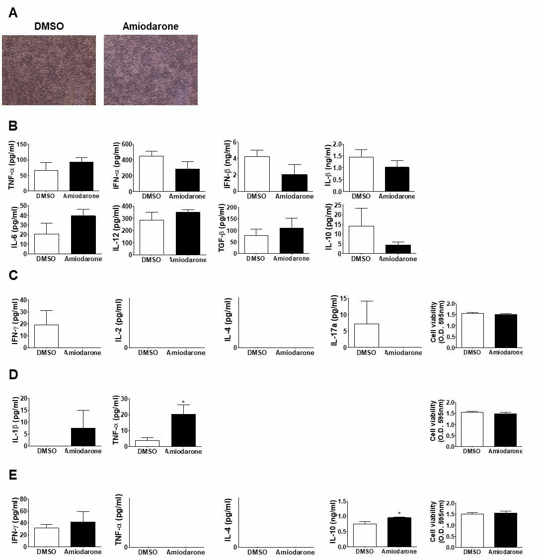 Amiodarone 처리에 의해 간독성이 나타나지 않음을 줄기세포 유래 간세포를 이용해 보임으로써 본 시스템을 증명함