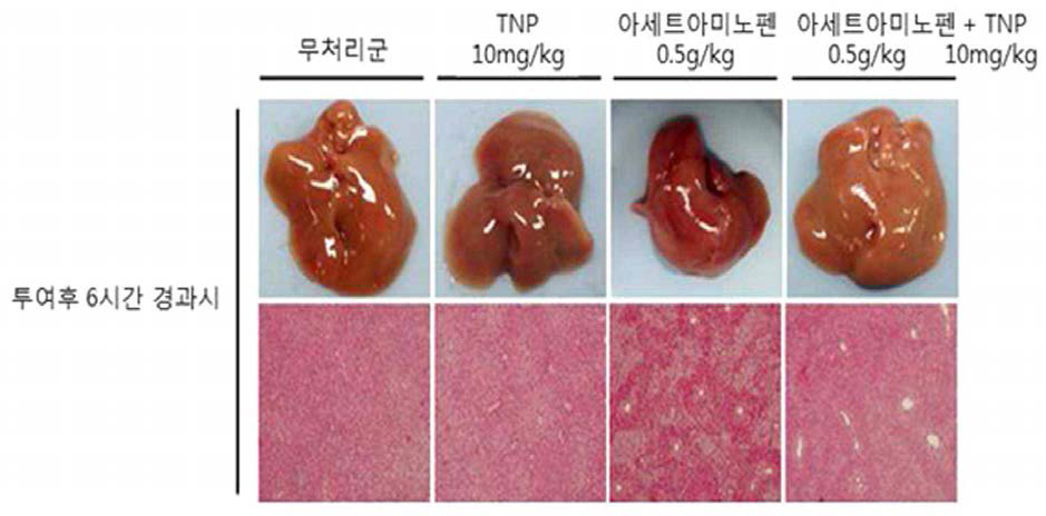 생쥐모델에서의 TNP 처리에 따른 APAP 간독성 보호효능분석 (조직분석)