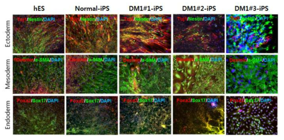 DM1-hiPSC의 전분화능 특성 확인