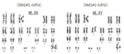 DM1-hiPSC의 정상핵형 확인