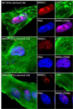 DM1-특이 심근 세포에서의 MBNL1 축척 확인