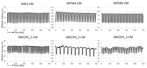 DM1-특이 심근 모델의 contraction 분석