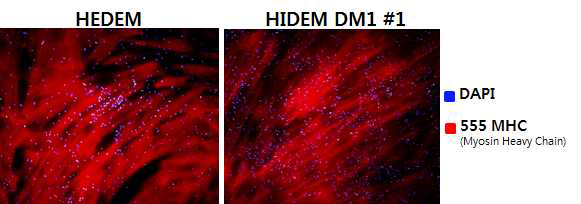 근육 세포 특이적인 MHC 마커 발현 확인