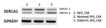 DM1-특이 근육 세포에서 SERCA1의 비정상적 splicing