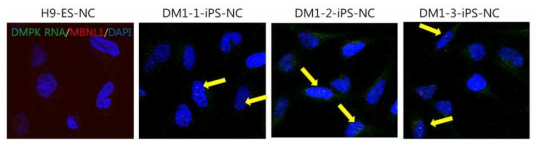 DM1-특이 신경능선 세포에서의 RNA 축척 및 MBNL1 위치 확인