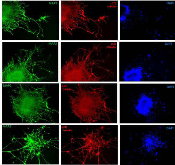 줄기세포로부터 성숙한 신경세포로의 분화 확인