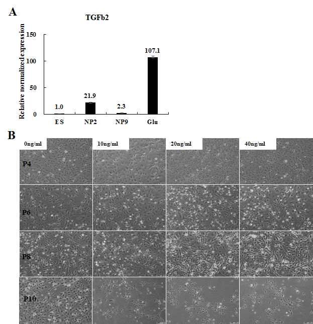 분화단계에서 TGF-β2 발현 변화 및 TGF-β2 첨가 배지에서 신경전구세포의 형질 변화