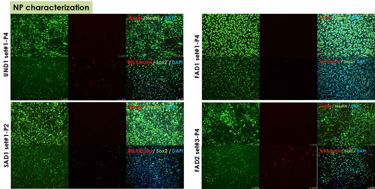 역분화 줄기세포 유래 신경전구세포의 분화 조건 확립 및 분화 특성 검증