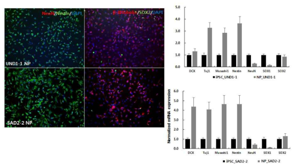 인간 줄기세포 유래의 cholinergic neuron 분화과정 중 Neural progenitor cell의 특성 분석