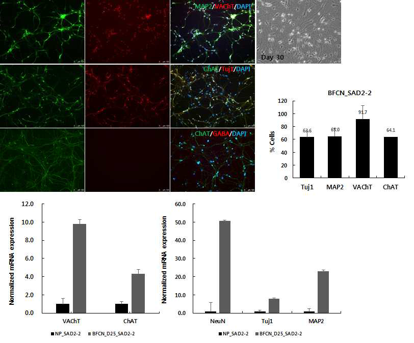 역분화 줄기세포 유래의 cholinergic neuron 분화