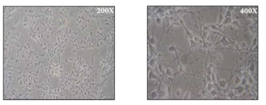 Bright-field image of embryo 14 cortical neurons after 72 hours in culture.