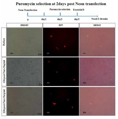 Puromycin selection at 2 days post Neon transfection