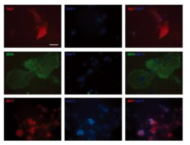 역분화생식줄기세포의 외배엽, 중배엽, 내배엽 마커인 Tuj1, SMA, AFP의 발현.