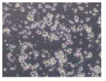 영양세포가 없는 조건에 서 배양되고 있는 wildtype 생쥐 의 생식줄기세포