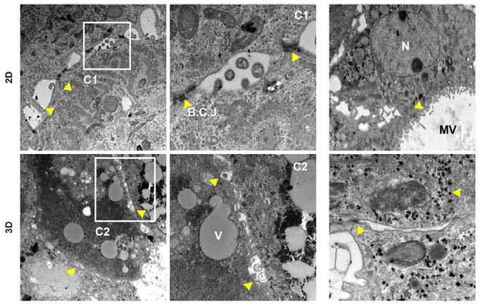 각각 2D, 3D로 배양한 간세포의 세포소기관의 구조를 투사전자현미경(TEM)을 이용해 관찰하였음.