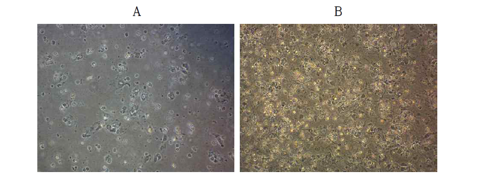 (A) 동결된 간전구세포를 insulin-transferrin-selenium이 포함된 DMEM/F12 배양액을 이용하여 해동시킨 후 15시간이 지난 뒤의 phase contrast 사진. (B) 동결된 간전구세포를 insulin-transferrin-selenium과 glucose가 포함된 DMEM/F12 배양액을 이용하여 해동시킨 후 15시간 뒤의 phase contrast 사진.