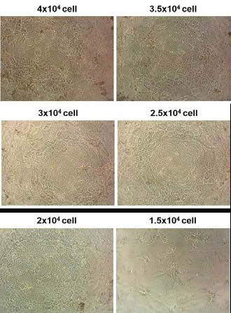 간세포 분화과정 중 hepatic maturation 유도 단계 직전 세포를 density별로 96well plate에 seeding한 뒤의 phase contrast 사진.