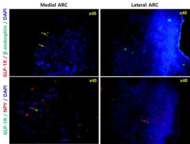 ARC에서의 GLP-1 수용체 뉴런 분포