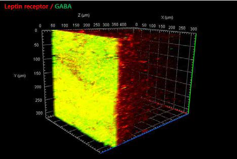 뇌 투명화 기술을 이용한 GABA뉴런과 Leptin 수용체 뉴런 확인