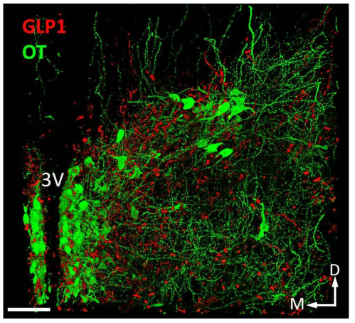 CLARITY 기술을 활용하여, Rat hypothalamus 의 신경조직 3차원구조 규명