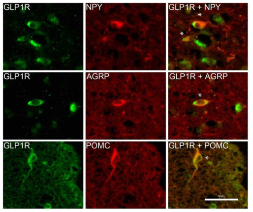 인체 시상하부 면역형광염색 결과 (The Journal of Clinical Endocrinology