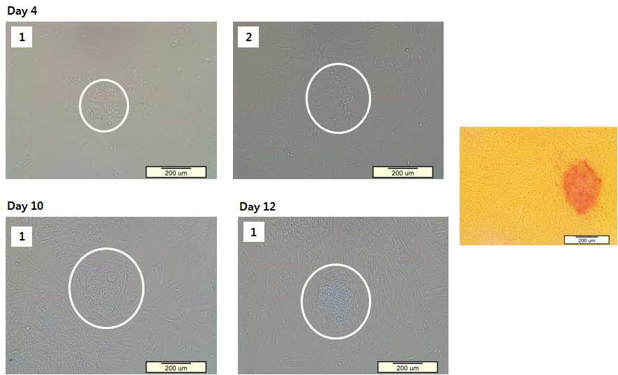 인간 iPSCs의 4일, 10일, 그리고 12일의 morphology를 담은 광학현미경 사진과 AP staining을 진행한 사진