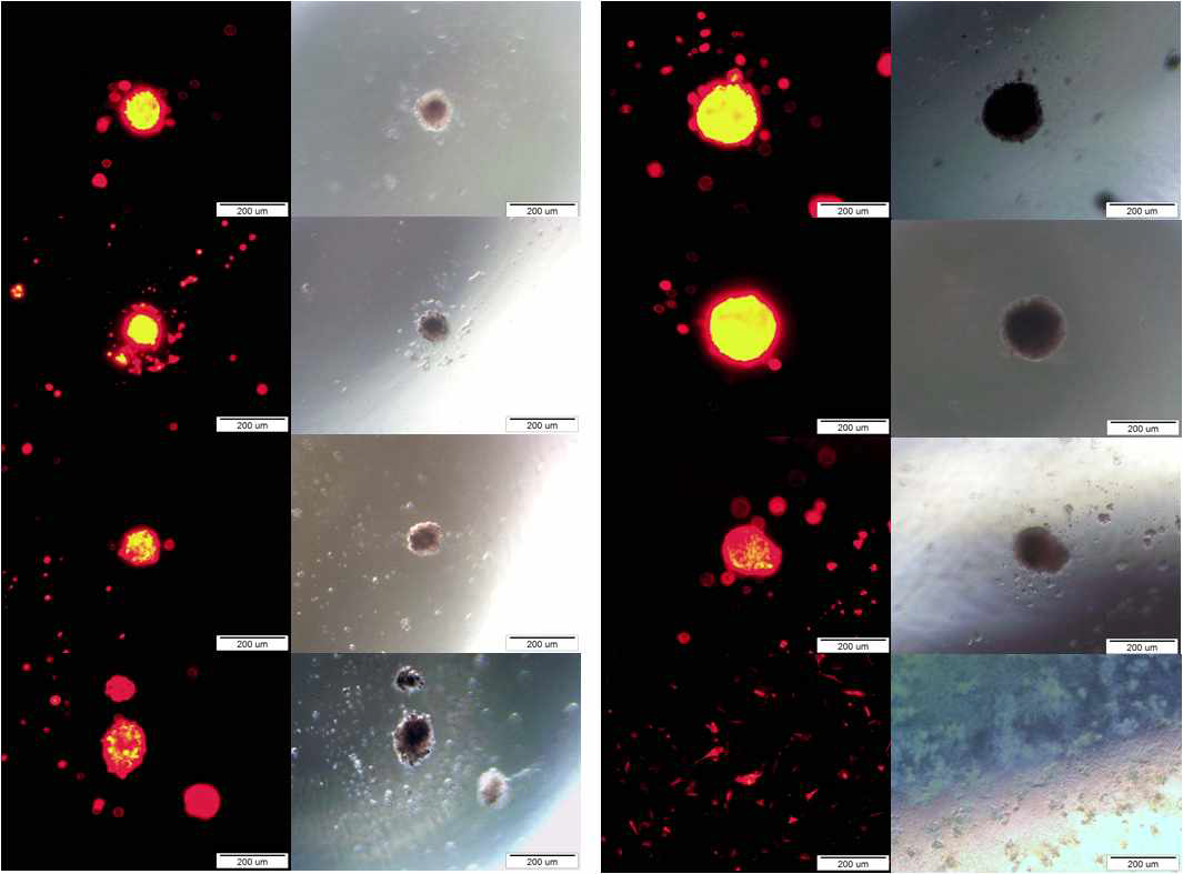 자성나노입자가 도입된 각각의 인간배아줄기세포 및 feeder cell의 다양한 형태 3차원 세포클러스터 형성 사진