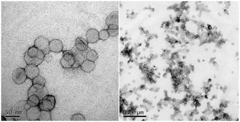 나노리포좀의 Negative-stain TEM 이미지