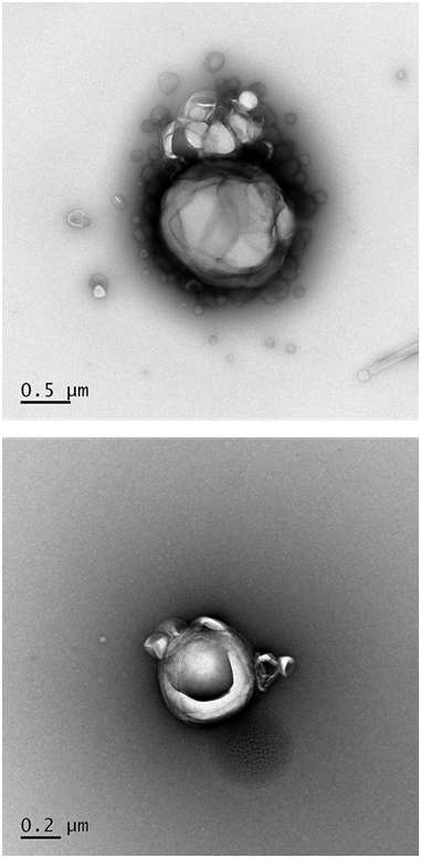 TEM images of non-extruded non-pegylated liposome dispersion