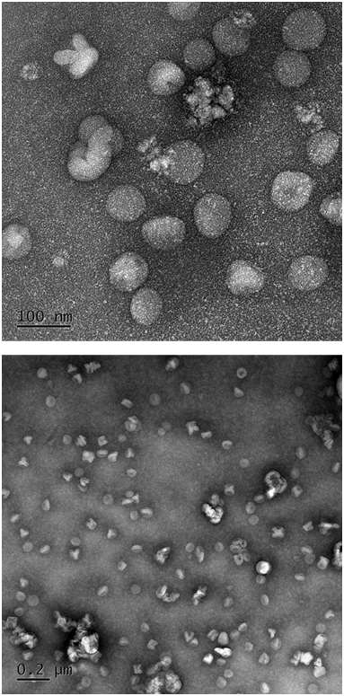 TEM images of extruded non-pegylated liposome dispersion