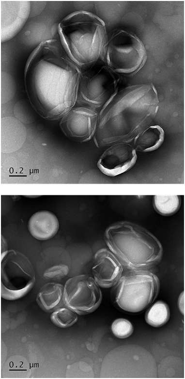 TEM images of non-extruded pegylated liposome dispersion