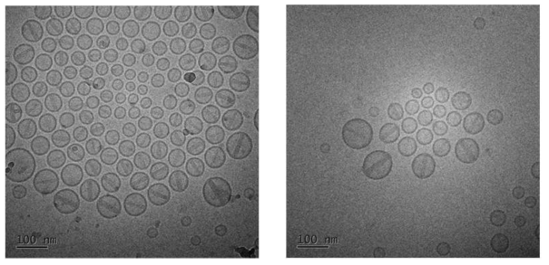 The cryo-TEM images of the doxorubcin entrapped liposome dispersion