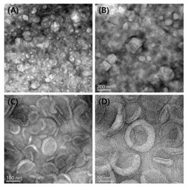 non-extruded(A,B) and extruded(C,D) SCF-ACZ 리포좀의 TEM images