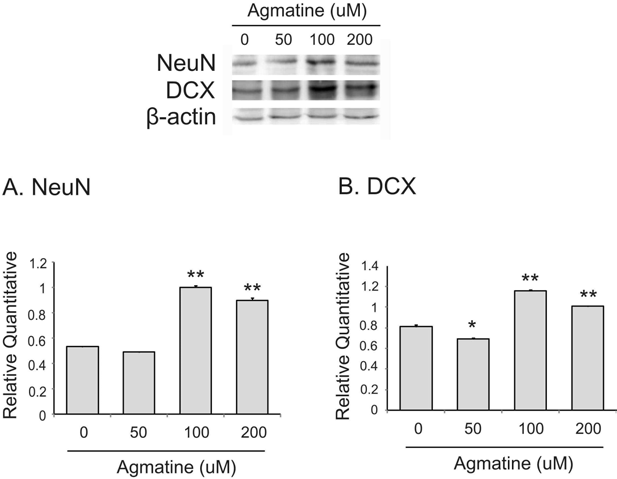 아그마틴 처치후 신경줄기세포에서 NeuN(A)과 DCX(B) 단백질 발현의 변화