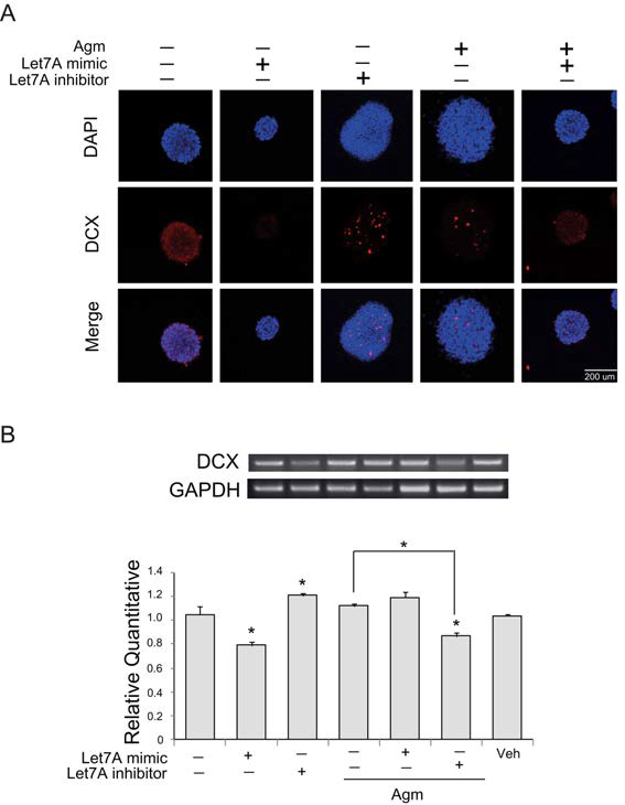 아그마틴 처치후 신경줄기세포에서 DCX mRNA 발현 및 면역 반응성