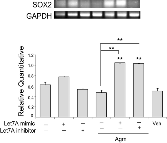 아그마틴 처치후 신경줄기세포에서 SOX2 mRNA 발현 변화