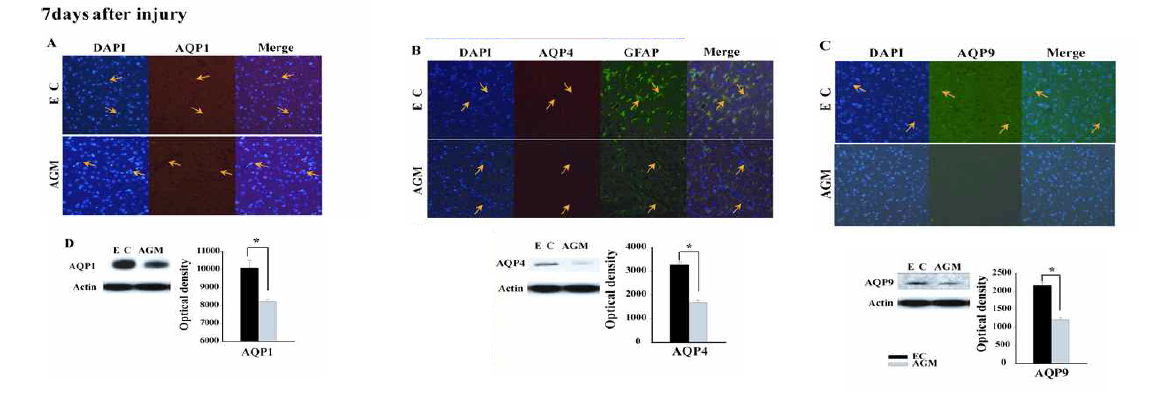 외상성 뇌손상 이후 아그마틴 투여에 의한 AQPs억제 및 뇌부종 형성 경감 효과