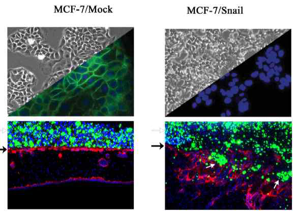 E-cadherin Repressor Snail induces EMT and invasion in MCF-7 cells