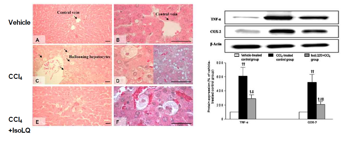 Hepatic histopathology, and TNF-α and COX-2 protein expression