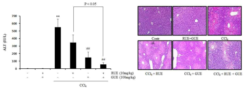 The effect of RUE and GUE on CCl4-induced acute liver toxicity