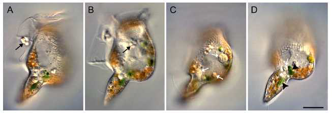 먹이생물 섬모류 Mesodinium coatsi를 섭식한 후 와편모류 Dinophysis caudata 내에 녹색 색소체의 분포. 세포내 여러 부위에 흩어져 분포하고 있음을 알 수 있음.